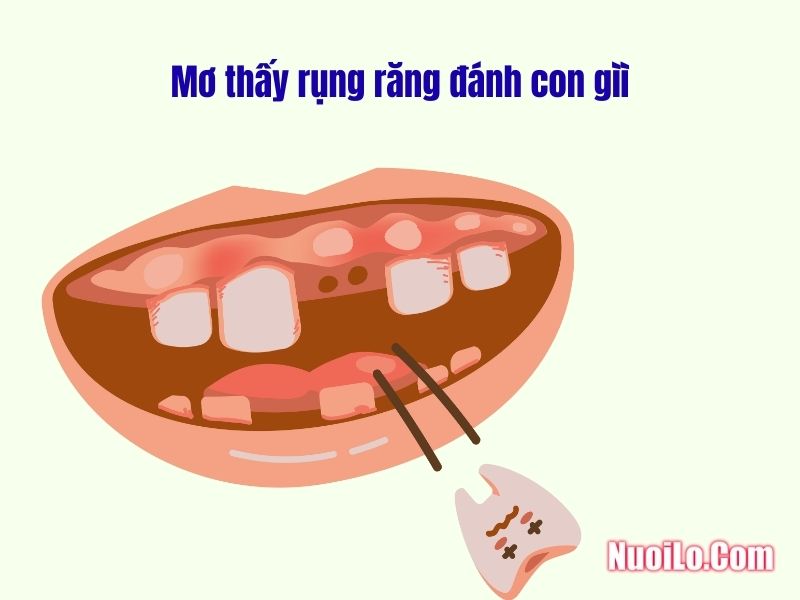 Mơ thấy rụng răng đánh con gì